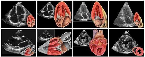 what is 2d echo test.